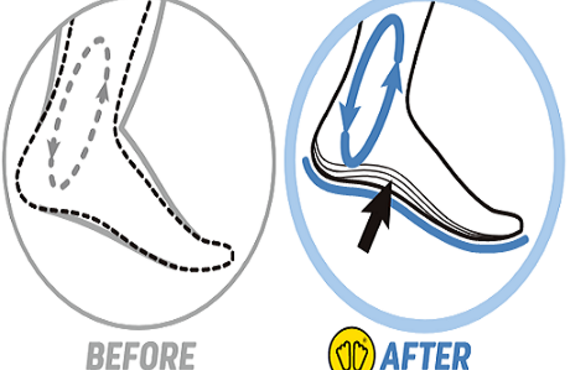 カスタムインソール　むくみ