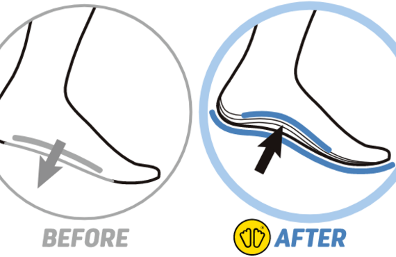 シダスカスタムインソール　偏平足