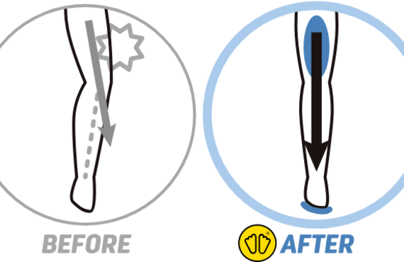 インソールイベント　足の痛み