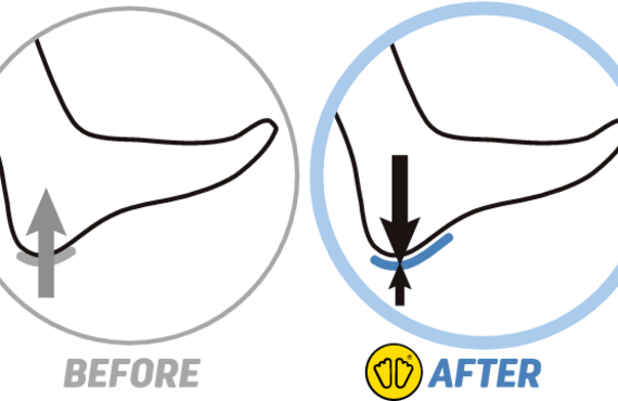 オーダーメイドインソール　アキレス腱炎