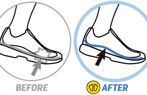 オーダーメイドインソール　たこまめ　水ぶくれ